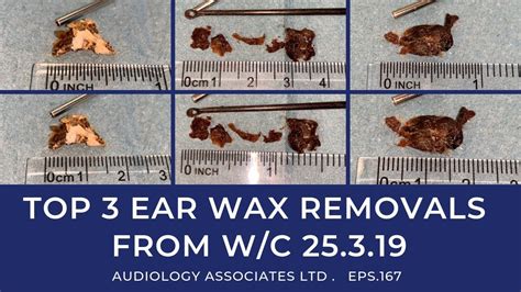 Ear wax removal $99–$139; Epinephrine injection pen refills $89; Eyelash lengthening consultation $99–$129; Fatigue Evaluation* $99–$139* Food sensitivity test* $99–$139* …